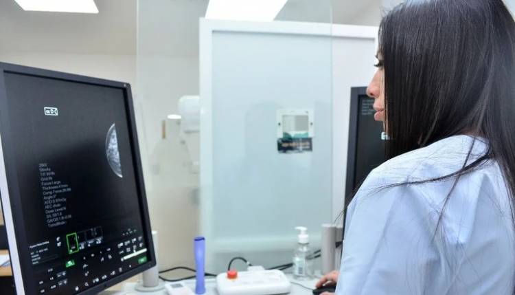 VILLA MERCEDES: amplían los turnos de mamografías 